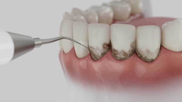 Reliable Dental Implants contractor in Cushing, OK by Smile Center Dentistry